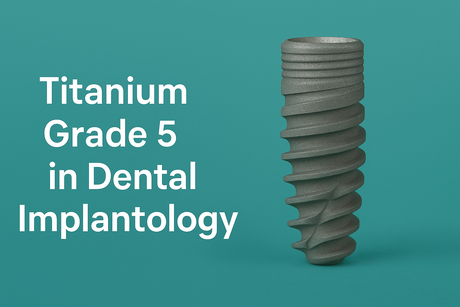Titanium Grade 5 in Implant Dentistry: Why It Matters