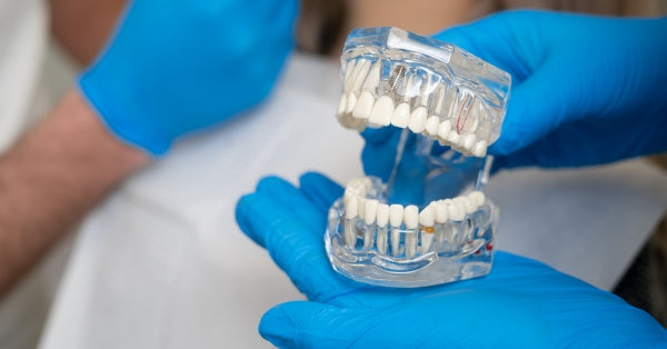  Implantology: Essential Insights for Dental Experts 