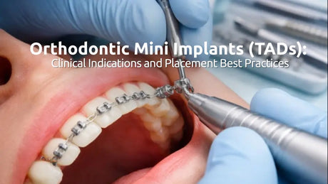  Orthodontic Mini Implants (TADs): Clinical Indications and Placement Best Practices 