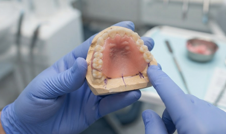 What Is a Soft Reline for Dentures 