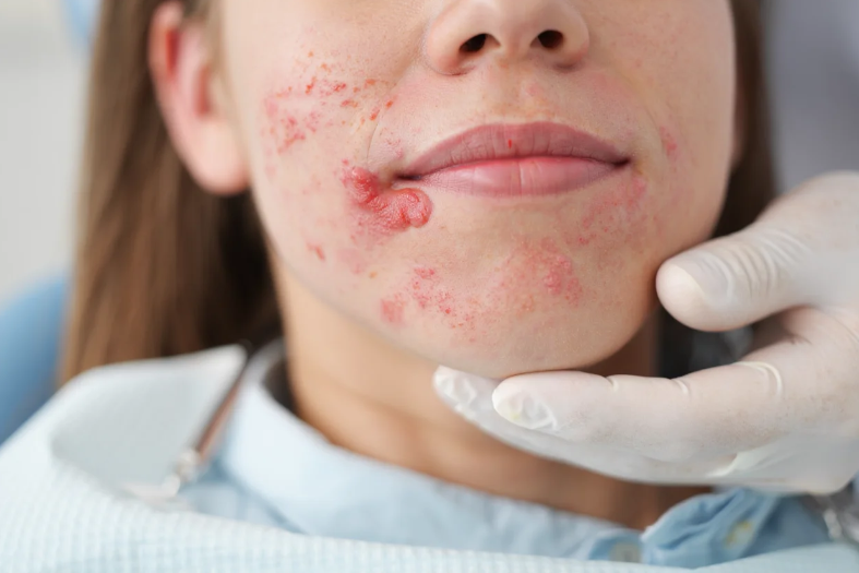  Allergic Reaction to Novocaine 