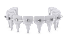  orthodontic supplies 