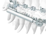 Dentaurum Sus³ Sabbagh Universal Spring Application Set Fixed Appliances