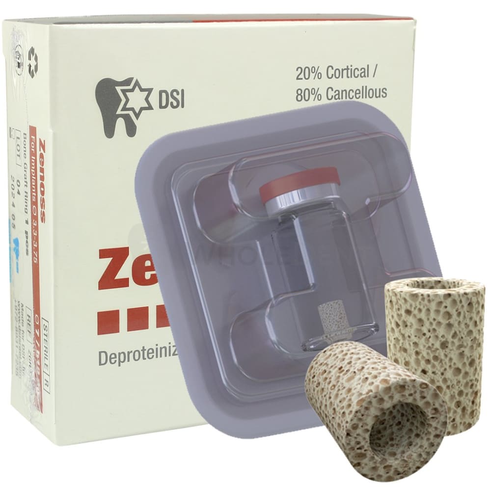 DSI Zenoss Bone Ring Transplant - WholeDent