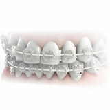 Morelli NiTi Superelastic Aesthetic Round Archwire Upper Jaw-Orthodontic Wire-WholeDent.com