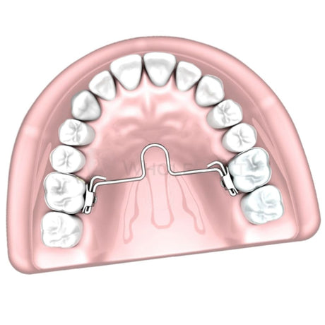  Morelli Palatal Bar With Mesial Loop 