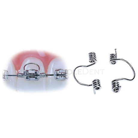 Ortho Arch The Goodman Torquing Springs Orthodontic Spring