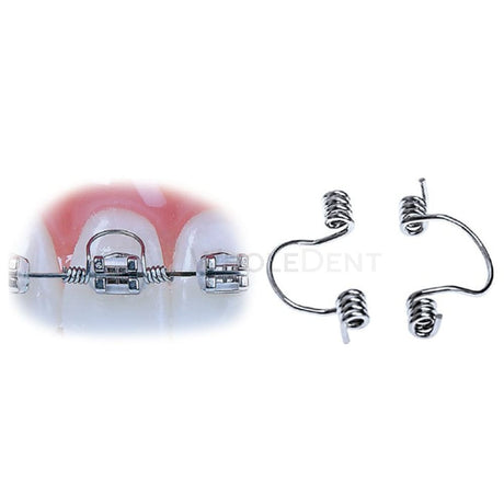  Ortho Arch The Goodman Torquing Springs Orthodontic Spring 